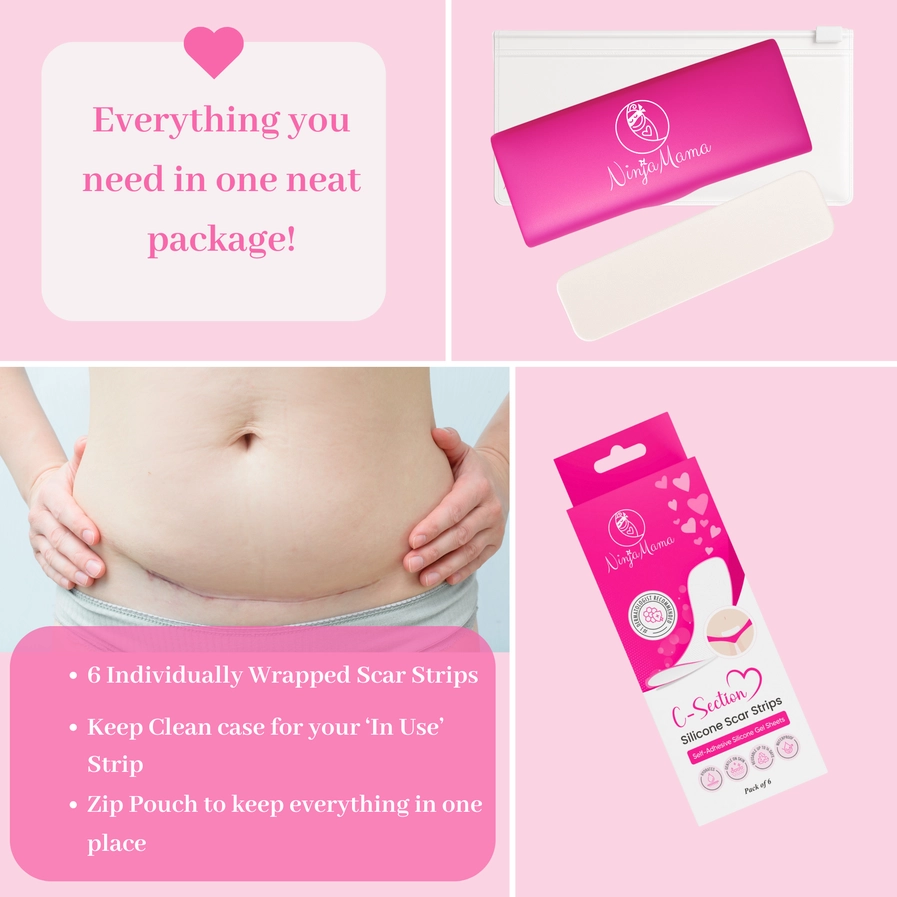 Ninja Mama Transparent C-Section Silicone Scar Strips - Pack of 6 - Image 6